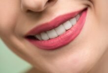 How To Make Teeth White Naturally From Yellow