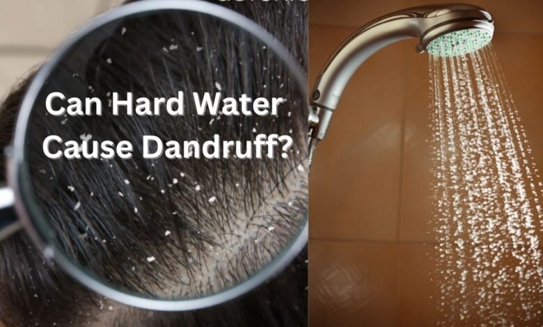 Can Hard Water Cause Dandruff